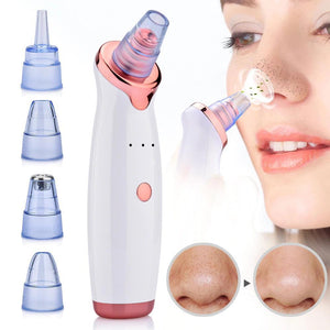 SK™ Blackhead Remover